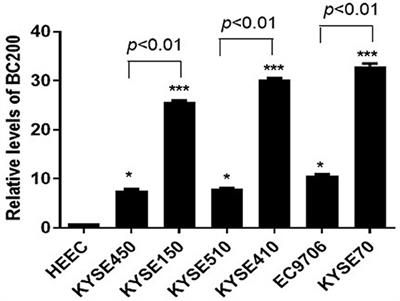 LncRNA BC200 Promotes Esophageal Squamous Cell Cancer Migration and Invasion and Can Regulate ATF4 Expression